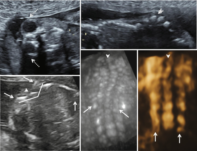 figure 35