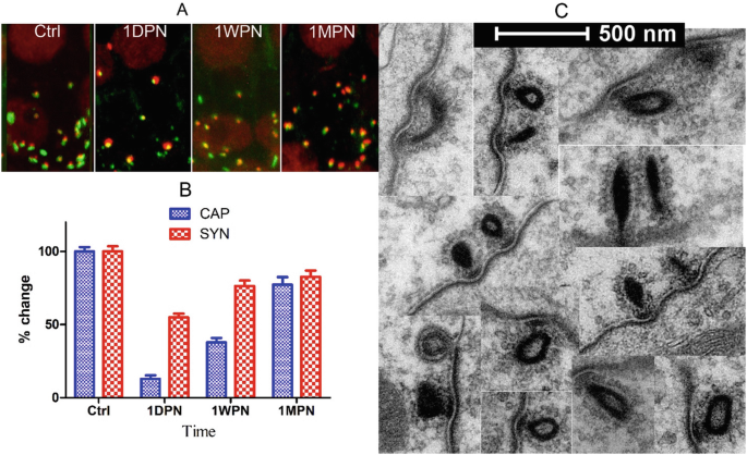 Zinc deficiency triggers hearing loss by reducing ribbon synapses of inner  hair cells in CBA/N mice - ScienceDirect