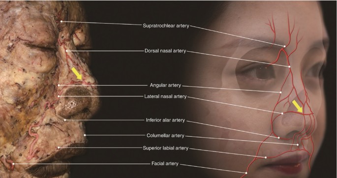 فیلرهای پوستی