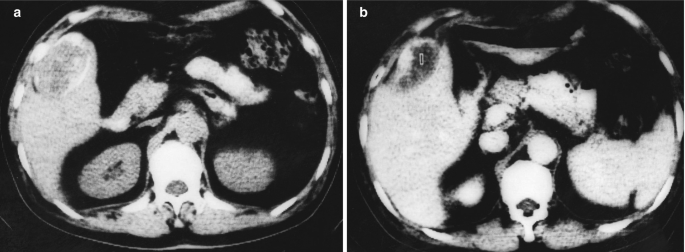 figure 28