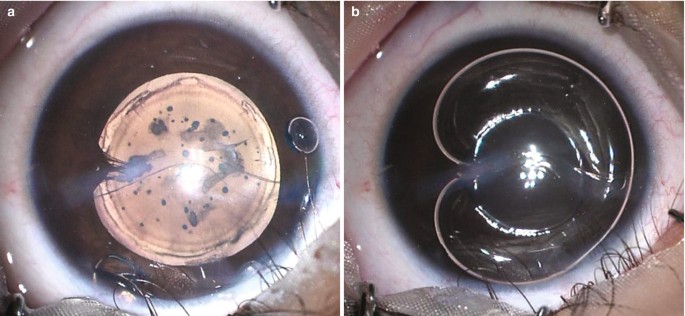 figure 17