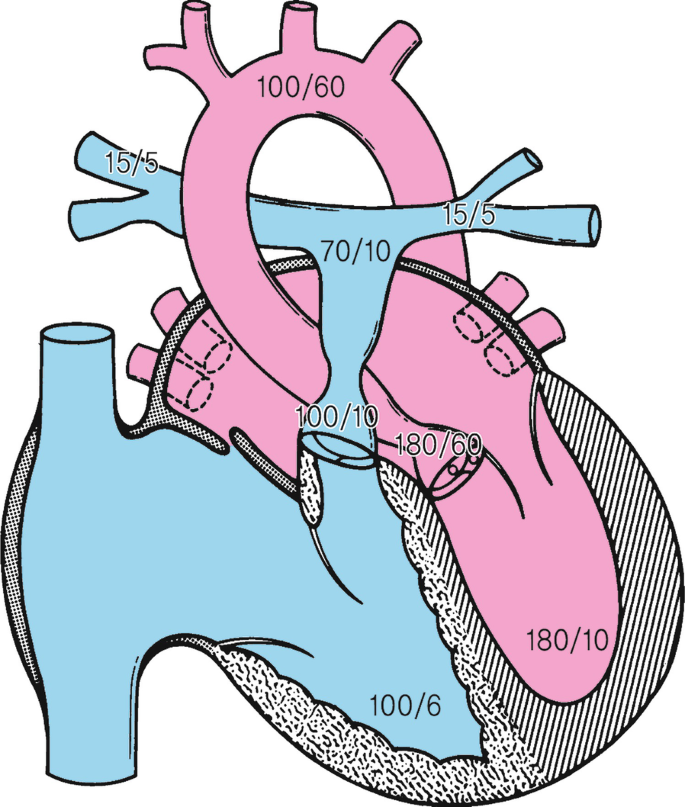 figure 41