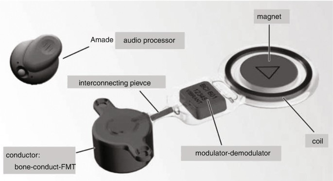 figure 34