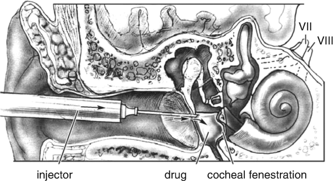 figure 41