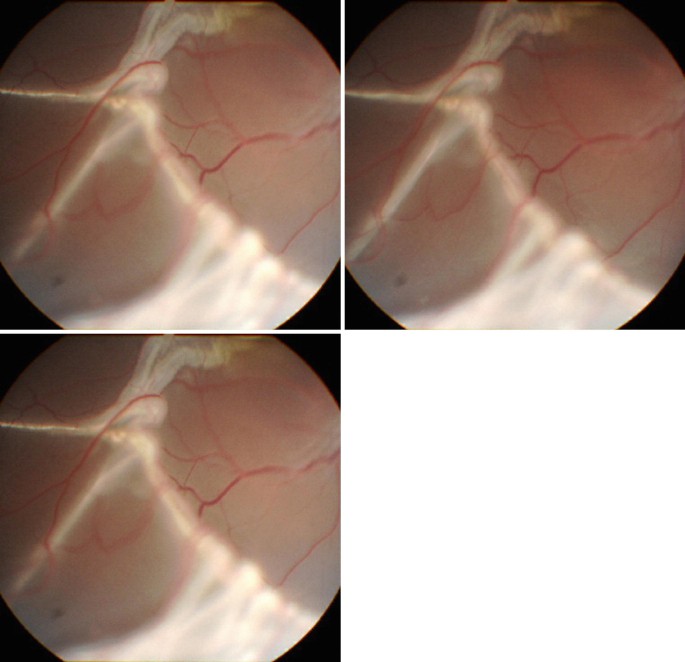 figure 45