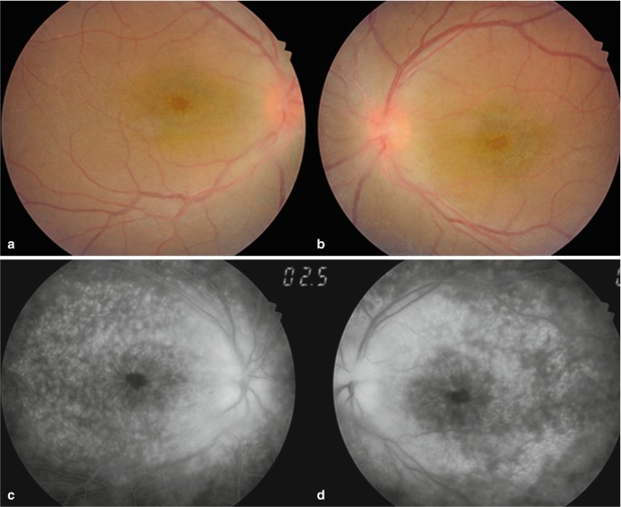 figure 23