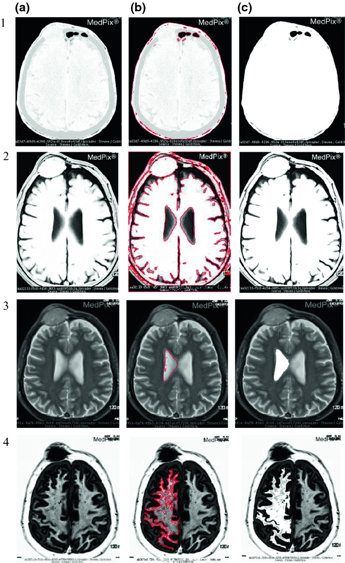 figure 18