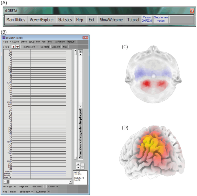 PDF) A test of brain electrical source analysis (BESA): A simulation study