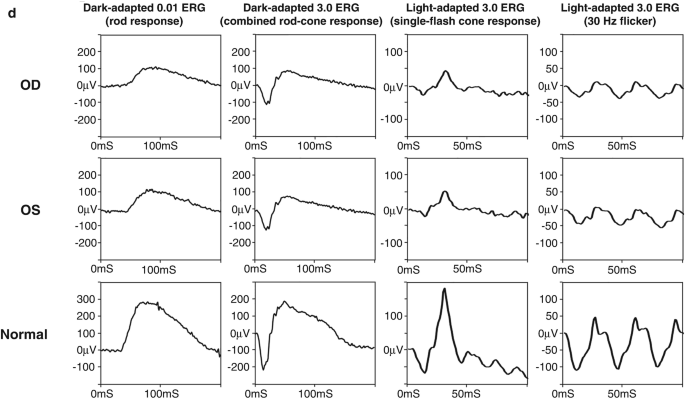 figure 36