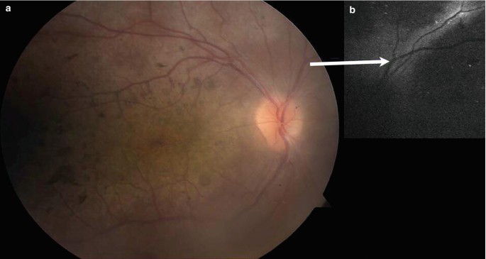 figure 40