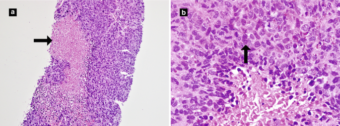 figure 17