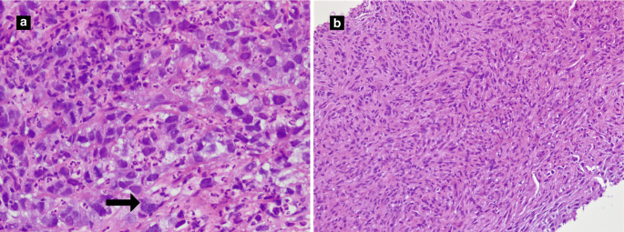 figure 21