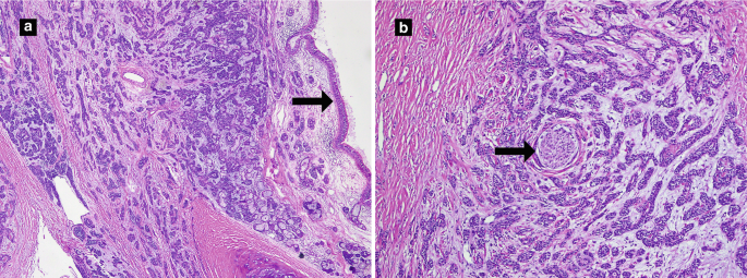 figure 23