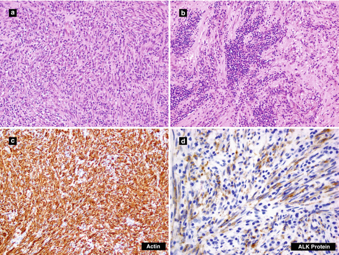 figure 25