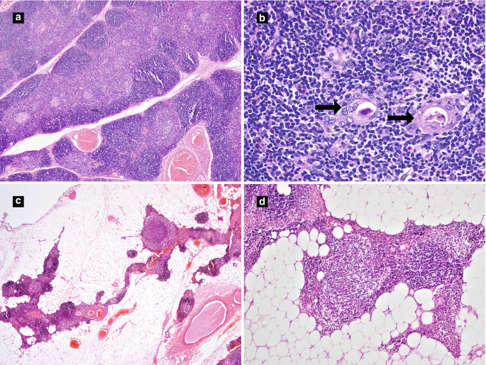 figure 28