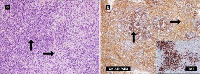 figure 31