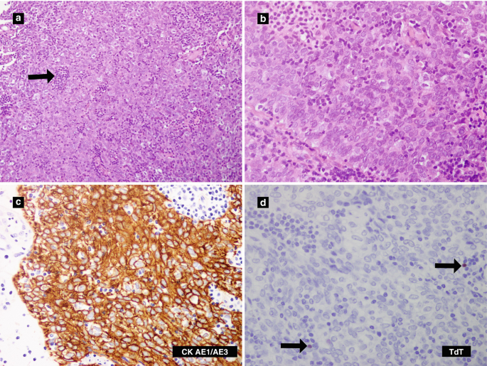 figure 34