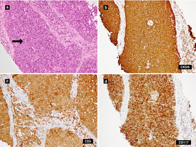 figure 35