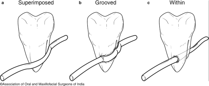 figure 19