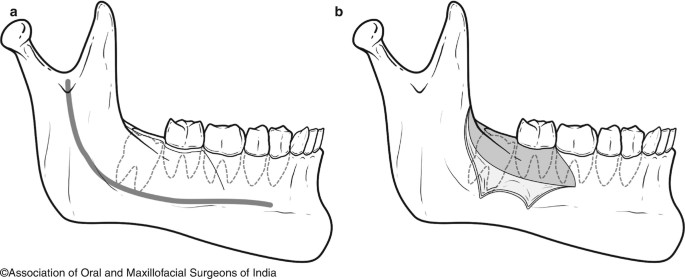 figure 23