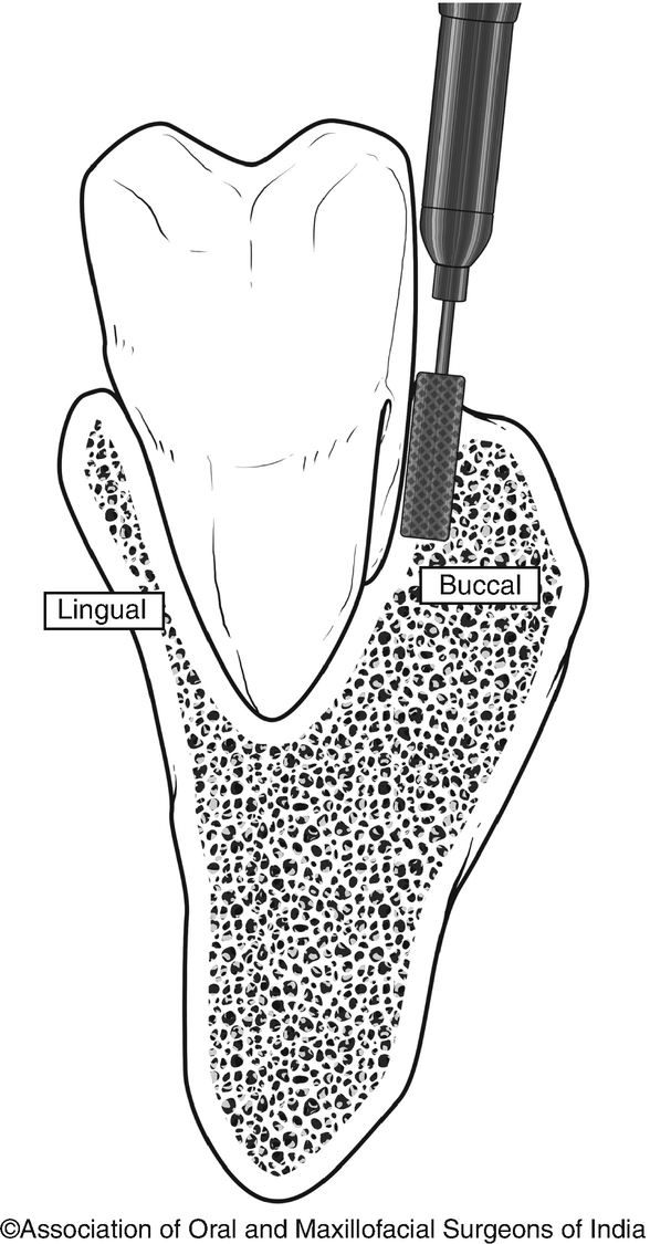 figure 25