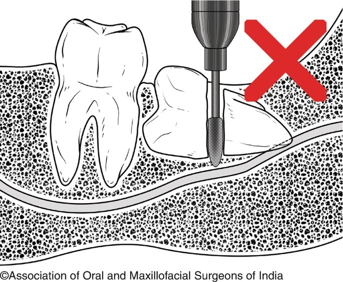 figure 26