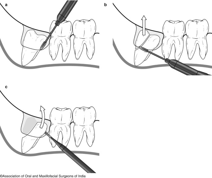 figure 27