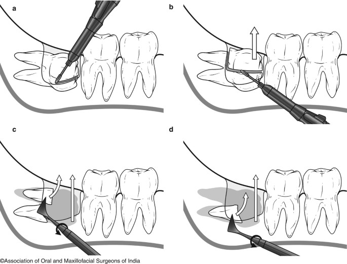 figure 28