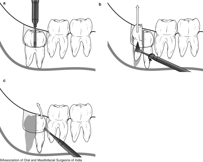 figure 29