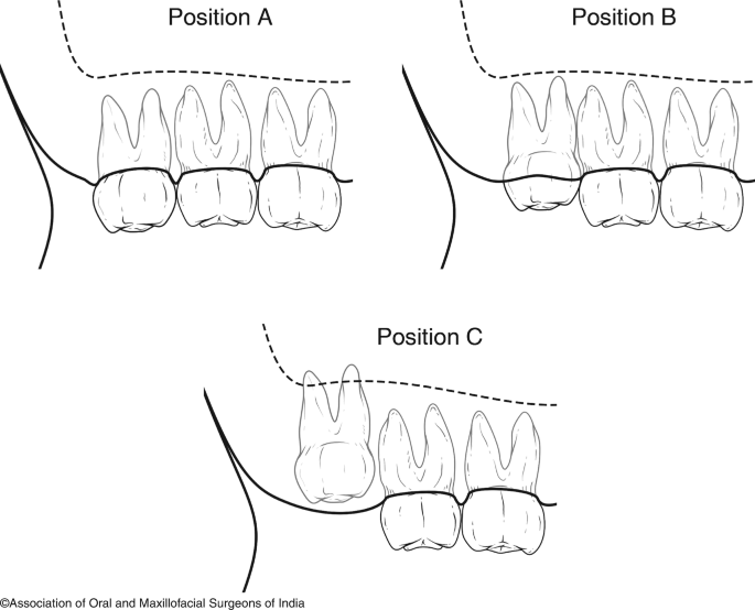 figure 32