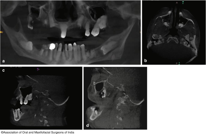 figure 33