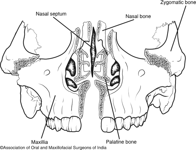 zygomatic bone maxillary process