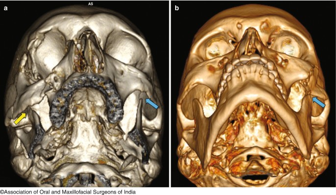 figure 20