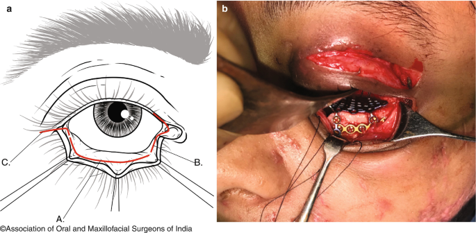 figure 25