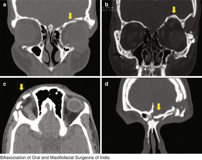 figure 30