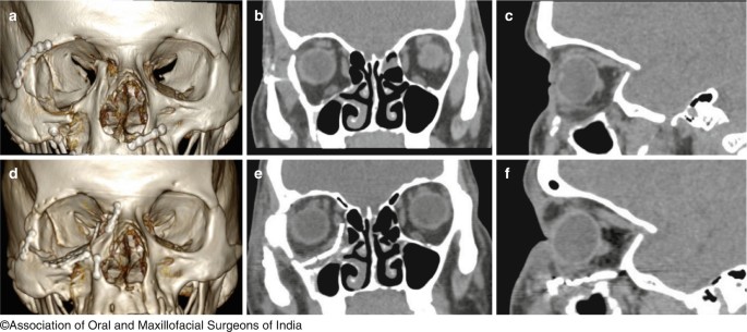 figure 49