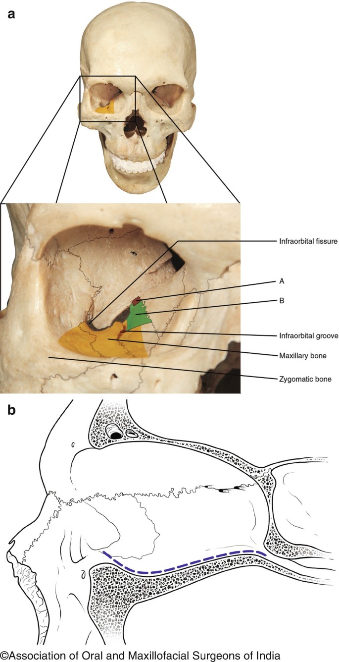 Wilson Disease - Gastrointestinal - Medbullets Step 1