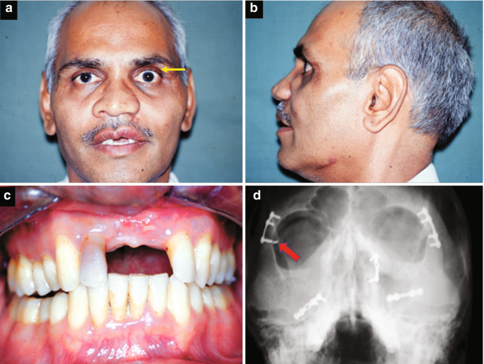 figure 16