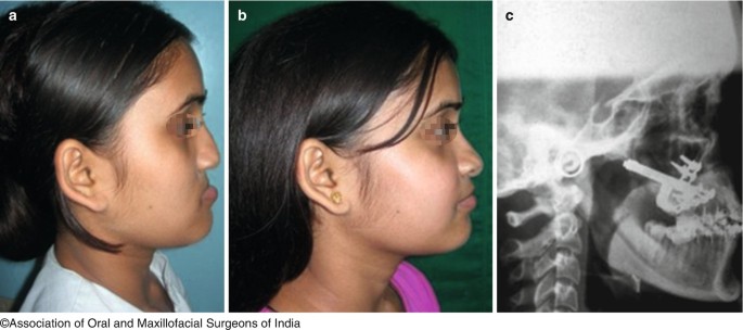 figure 17