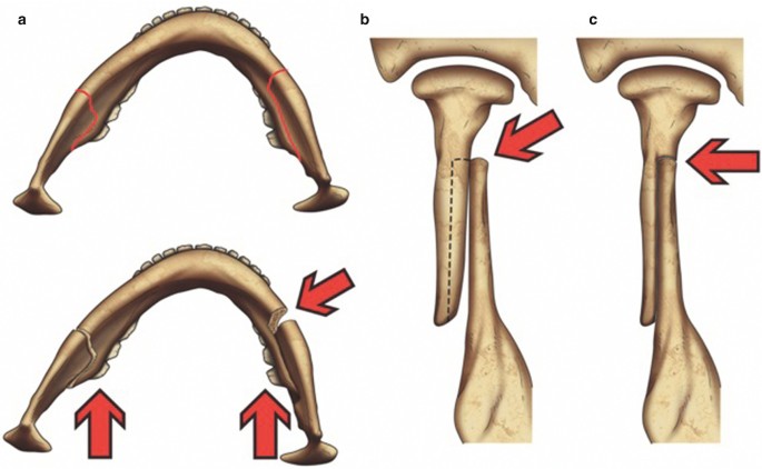 figure 19