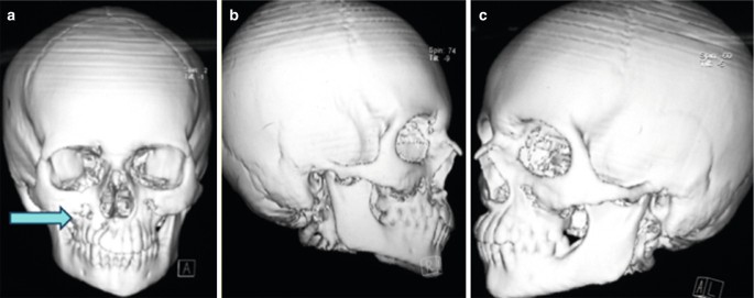 figure 32