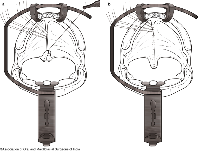 figure 27