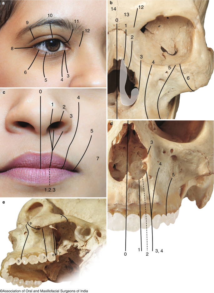 figure 22