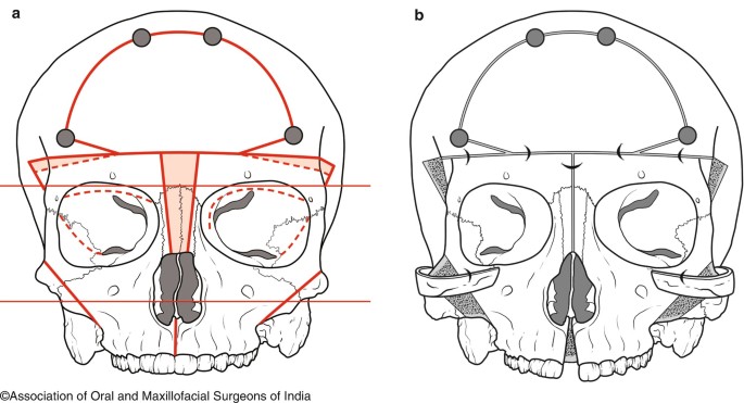 figure 27