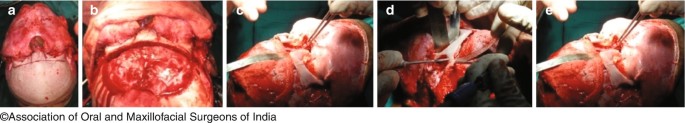 figure 29