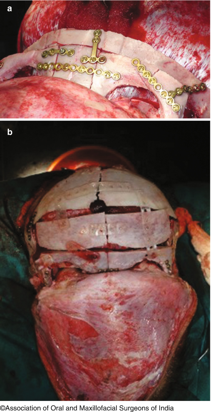 figure 41