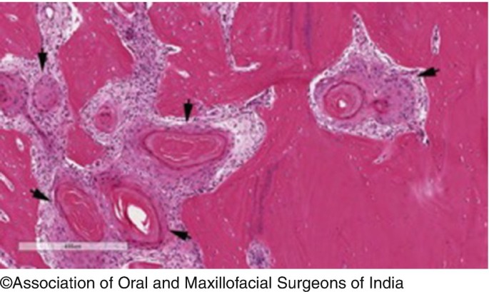 figure 22