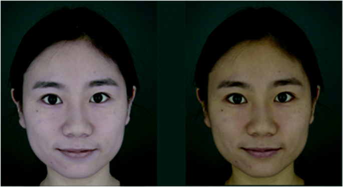 Chinese Skin Colour Preference of Different Genders | SpringerLink