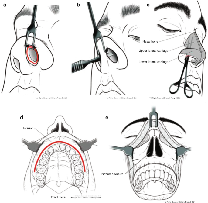 figure 30