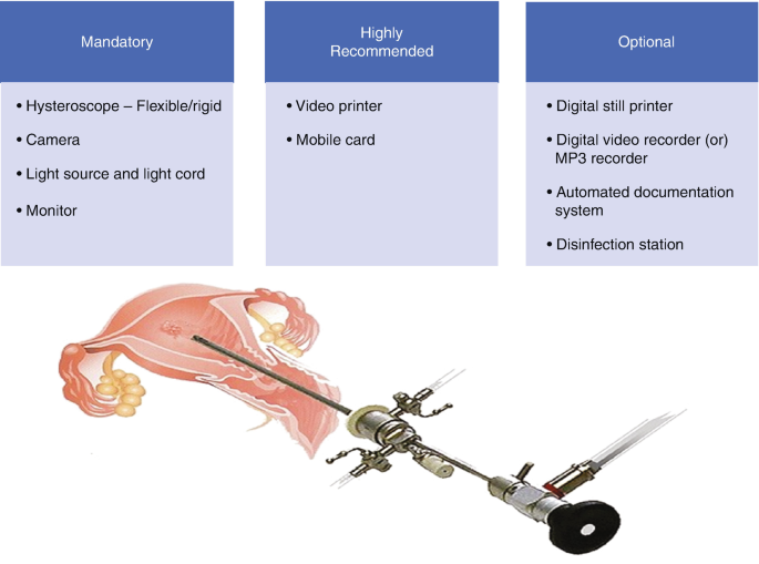 Office Hysteroscopy | SpringerLink